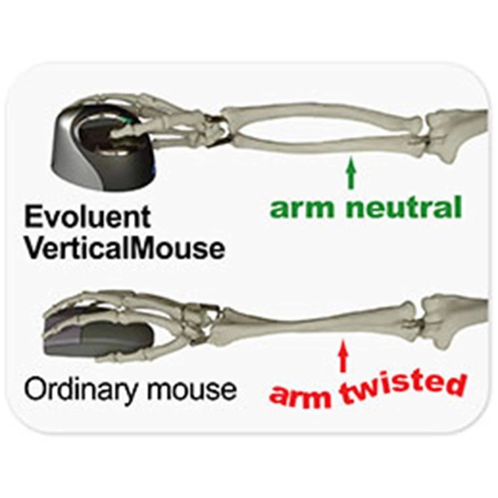 VerticalMouse 4 Right Mouse F923216